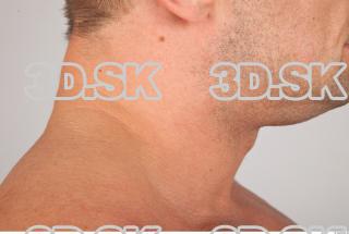 Neck texture of Gene 0004